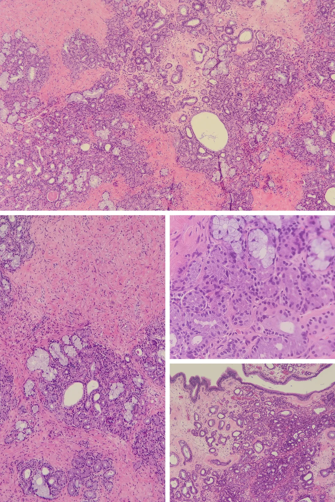 Histology Image