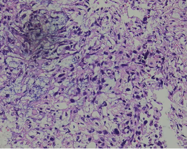 Urogenital Pathology : Various interesting cases in urological pathology.
